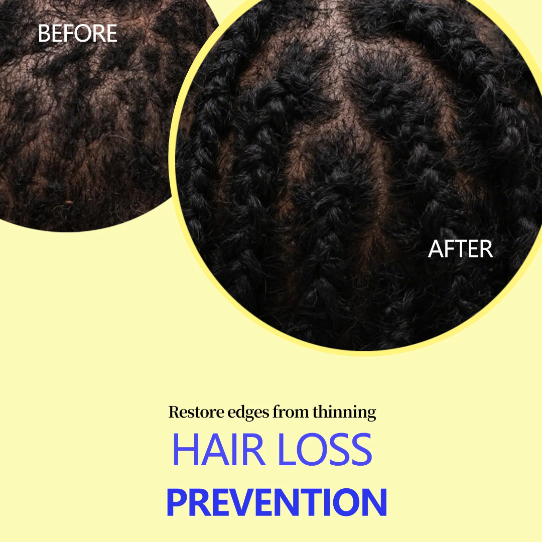 Creole Glow Herbal Elixir Hair Growth Oil