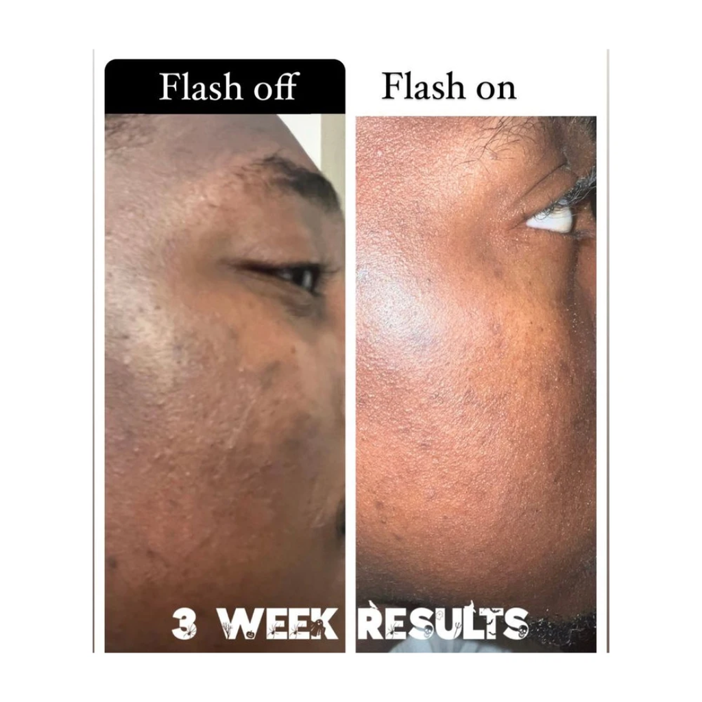 Creole Glow Asosi Soap | Detox & Clear Skin Bar