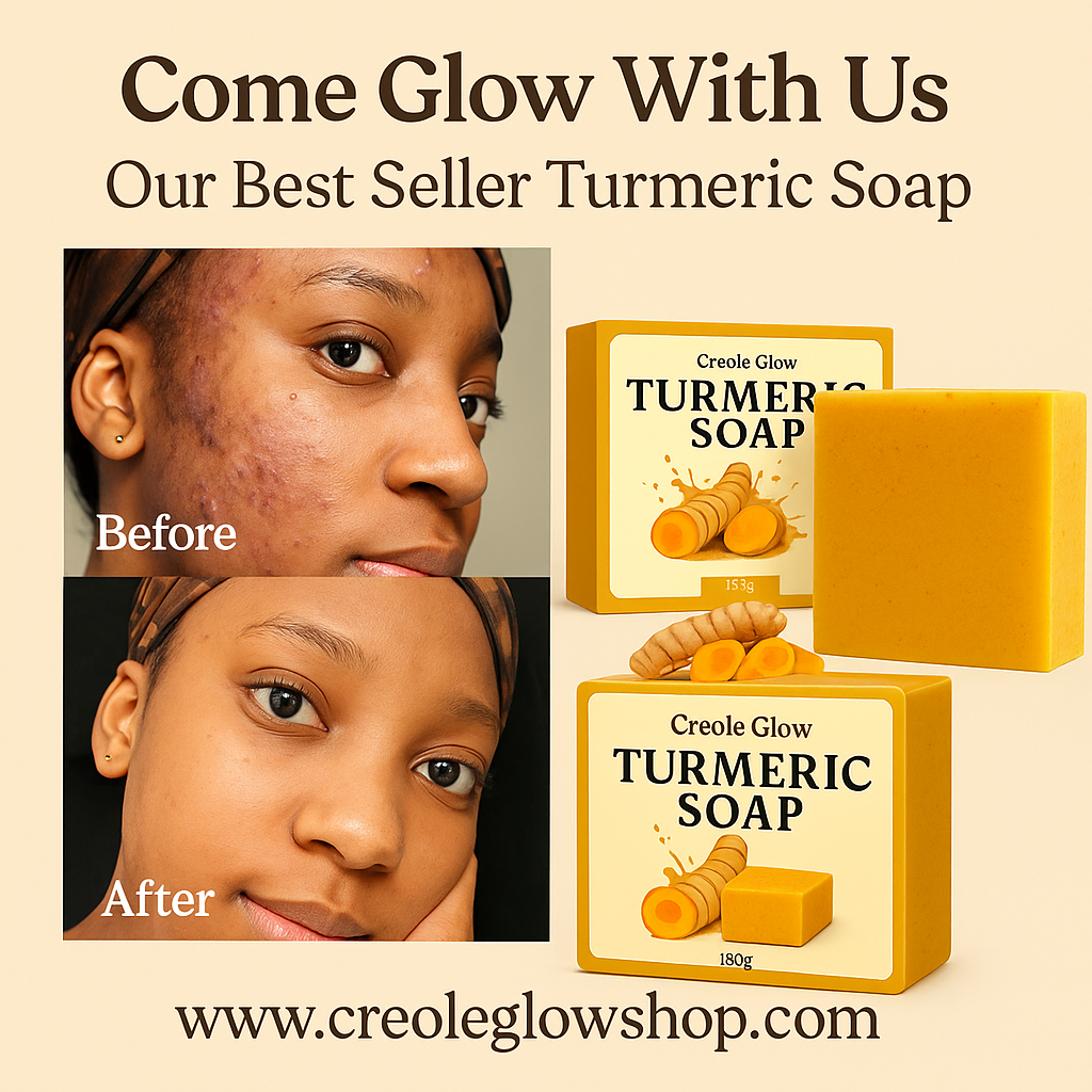 Creole Glow Turmeric Soap | Brightening & Even Tone Bar