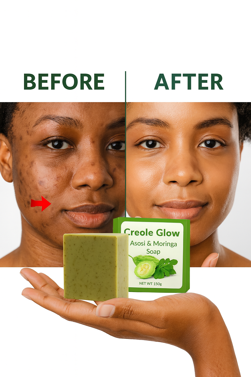 Creole Glow Asosi Soap | Detox & Clear Skin Bar