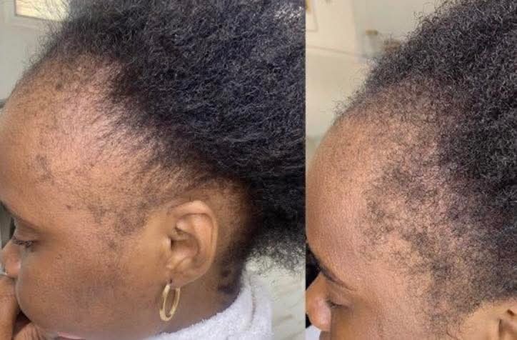 Creole Glow Herbal Elixir Hair Growth Oil