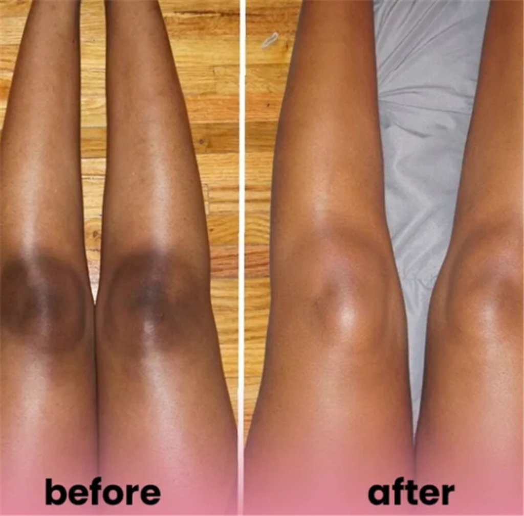 Creole Glow Turmeric Body Oil | Brightening & Nourishing – 4 oz